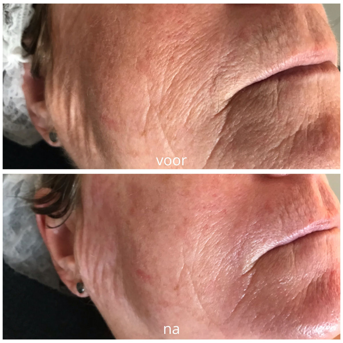 Glow Renewal Duo